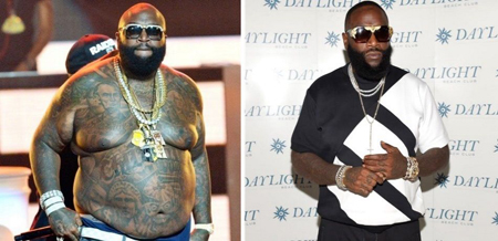 Rick Ross allegedly got weight loss surgery to get his weight down.